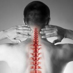 Gimdos kaklelio osteochondrozė